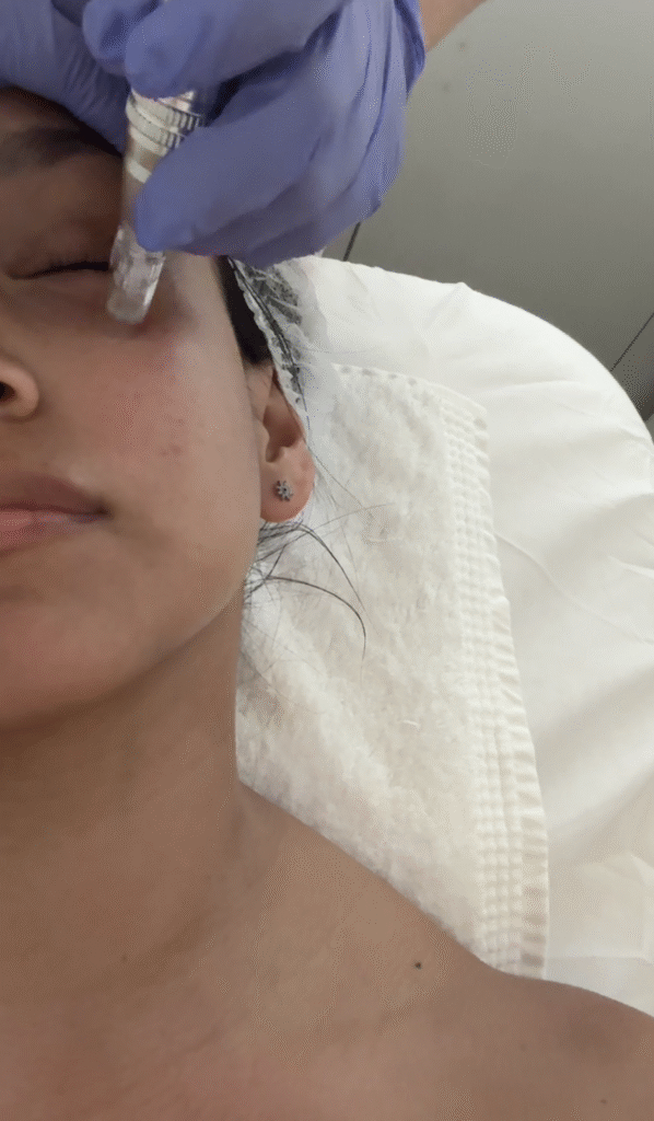 Dermapen